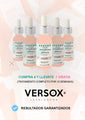 Versoxmx